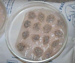 Follicular Units in Petri Dish